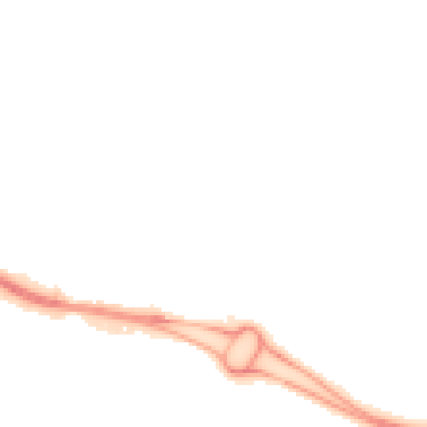 Night-time road noise heatmap for BS34 8AD